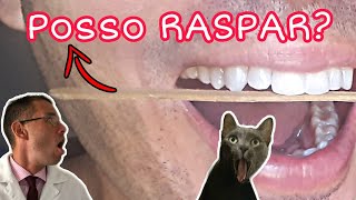 Posso RASPAR OS DENTES para IGUALAR O TAMANHO [upl. by Oyr515]