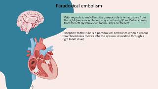 Paradoxical embolism [upl. by Derman]