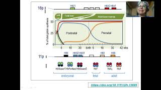 Aula anemia hemoglobinopatias [upl. by Dorie]