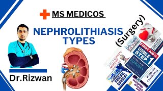 NephrolithiasisSurgeryMS MedicosDr RizwanUrdu Hindi Easy Explanations [upl. by Nevsa]