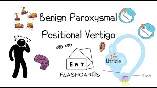 Benign Paroxysmal Positional Vertigo  FRCS ENT Exam Essentials [upl. by Renata]