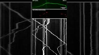 Example of Mitochondrial Movement in a Distal Axon Segment [upl. by Ellenid]