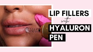 No Needle Lip Filler With Hyaluron Pen  Procedure And Aftercare Ft SaigeWellington [upl. by Niowtna877]