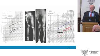 Comment il y a 43 ans un très jeune orthopédiste [upl. by Aiker]