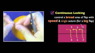 How Fast it is Practice Continuous Locking Suture [upl. by Hayikat]