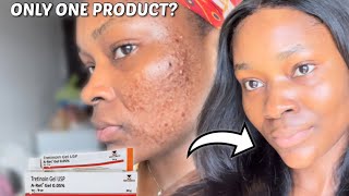 HOW TO ACHIEVE YOUR DREAM SKIN WITH TRETINOIN  How to use Tretinoin for beginners tretinoin [upl. by Eniaj]