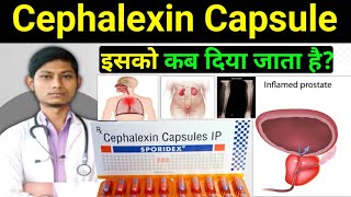 Cephalexin 500mg Capsule  sporidex 500 capsule  cephalexin capsules ip 500mg hindi [upl. by Pip919]