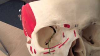 Cranial Nerves 6 of 12 Abducens Nerve  Head and Neck Anatomy 101 [upl. by Roach]