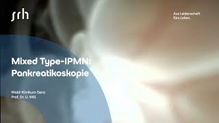 MixedTyp IPMN Pankreatikoskopie [upl. by Thirza719]