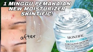 HONEST REVIEW Moisturizer Terbaru Skintific 5 Panthenol Acne Calming Water Gel [upl. by Ynabe400]