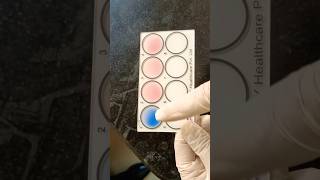 WIDAL TEST PART 2 hospital science lablife doctor labrador machine technology lab [upl. by Tamberg]