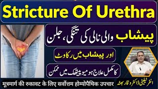 Stricture Of Urethra پیشاب کی نالی تنگ ہونا मूत्रमार्ग की सख्ती Homeopathic Treatment by In Urdu [upl. by Ellehcyar]