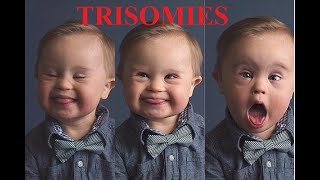 Trisomies các bệnh lý Ba nhiễm sắc thể [upl. by Arhaz17]