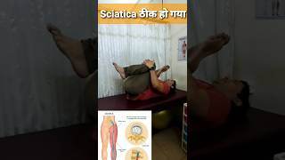 How to Fix Sciatica Pain Quick Relief [upl. by Beach]