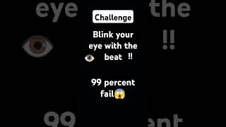 99 percent fail 🤔😱👁️ chessvibes logo [upl. by Ahseila]