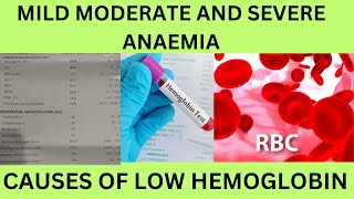 LOW HBHEMOGLOBINCAUSES SYMPTOMSCLASSIFICATION OF ANEMIAMILD MODERATE AND SEVERE ANAEMIA [upl. by Ttennej]