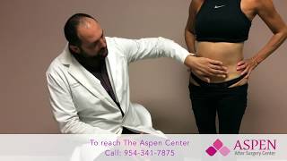 Liposuction Contour Irregularity  Stubborn Lipo Lumps and Bumps [upl. by Spiros276]