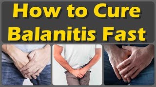 How To Cure Balanitis With Oils Fast And Causes Symptoms And Treatment Of Balanitis [upl. by Ithnan360]