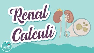 Renal Calculi AKA quotKidney Stonesquot  MedSurg Help for Nursing Students [upl. by Freddy]