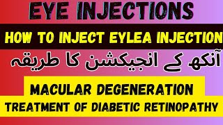 Intravitreal Eylea injection 💉  Intravitreal AntiVegf Injection  Dr Faisal Anwar [upl. by Ninahs]