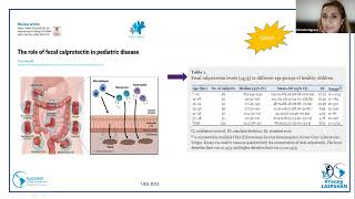 Webinar Young LASPGHAN Enfermedad de Crohn [upl. by Lorusso]