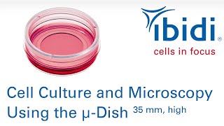 Cell Culture and Microscopy Using the µDish 35 mm high [upl. by Mannuela]