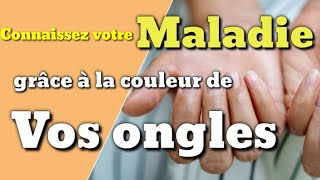 Connaissez votre maladie grâce à la couleur de vos ongles [upl. by Aikem]