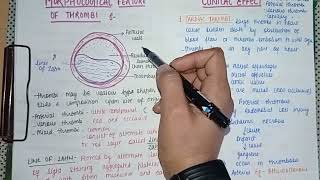 Thrombosis Part 2  Definition Causes Types Morphology amp Pathology [upl. by Buderus]