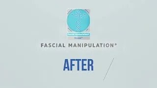 BEFORE amp AFTER FASCIAL MANIPULATION 2 [upl. by Acisey501]