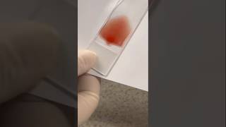 Blood smear 💉🩸  smear practical  blood practical medical neet satyujribadiya doctor shorts [upl. by Stenger]