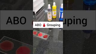 ABO blood grouping MBBS Pathology Practical Blood typing🩸 or Blood Grouping🩸 step by step shorts [upl. by Lilaj]