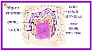 ORAL PATHOLOGY  DENTIGEROUS CYST FORMATION [upl. by Adah]