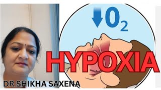 Hypoxic Classification of Hypoxia Telegram httpstmedrshikhasaxenahumanphysiology [upl. by Atinnek]