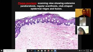 Lecture 4 Dermatopathology Psoriasiform and Spongiotic dermatoses [upl. by Einwahs]