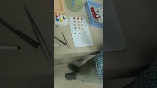 Blood grouping B positive Blood grouping bloodgroup shorts viralvideo medical medico students [upl. by Vasily703]