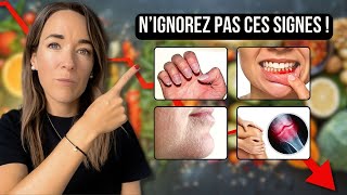 CES 11 SIGNES montrent que votre CORPS MANQUE DE NUTRIMENTS ESSENTIELS naturopathie [upl. by Aleak]