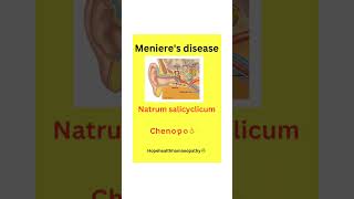 Ménières disease is a chronic inner ear disorder tinnitus deafness hopehealthhomoeopathy [upl. by Arotak431]