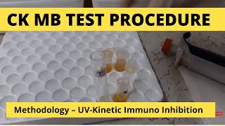 CK MB Procedure  Test for estimation of CKMB activity in serum [upl. by Jewel]