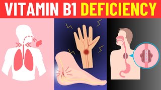 Top 10 Signs and Symptoms of Vitamin B1 Thiamine Deficiency [upl. by Gupta]