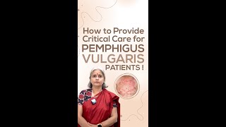 How to Provide Critical Care for Pemphigus Vulgaris Patients [upl. by Tadd343]