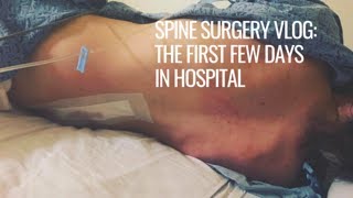 SPINE SURGERY VLOG the first few days in the hospital  rarebonesx [upl. by Geraldina887]