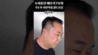 옆머리 두피문신교육 헤어라인 두피문신 밀도보강 두피문신수강 7주차 두피문신잘하는곳 브이로그 [upl. by Trudie]