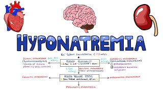 An Approach to Hyponatremia  Hyponatremia Diagnostic Algorithm  Hyponatremia Causes MADE EASY [upl. by Enwad200]