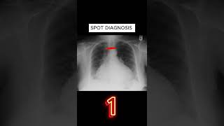 X ray quiz 31 nursing nursingstudent doctor USMLE MBBS hospital anatomy ctscan radiology [upl. by Nadabb]