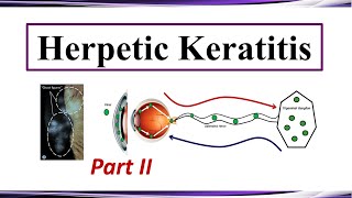 Herpetic Keratitis  Therapy Part II [upl. by Anovad]