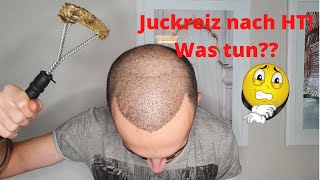 Juckreiz der Kopfhaut nach Haartransplantation Was tun [upl. by Leodora]