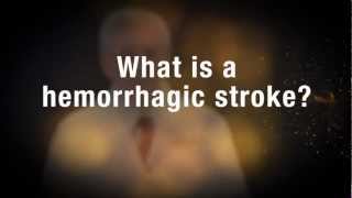 Medical Moment Hemorrhagic Stroke [upl. by Penthea]