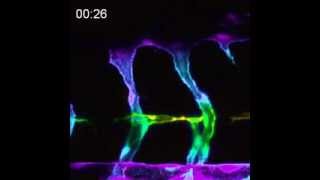 Endothelial cells in pten mutant zebrafish embryos form filopodia over time [upl. by Noemi134]