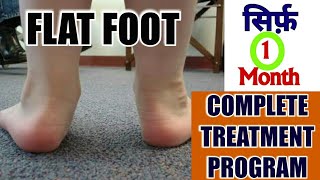 FLAT FEET TreatmentComplete Exercise PROGRAM To Correct Flat Feet OR FALLEN ARCHES [upl. by Kale848]