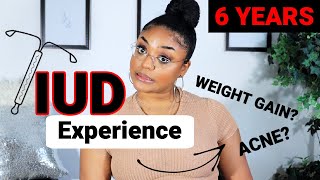 Honest IUD Experience⎜6 Years w IUD Mirena  Part 1 [upl. by Sergei]